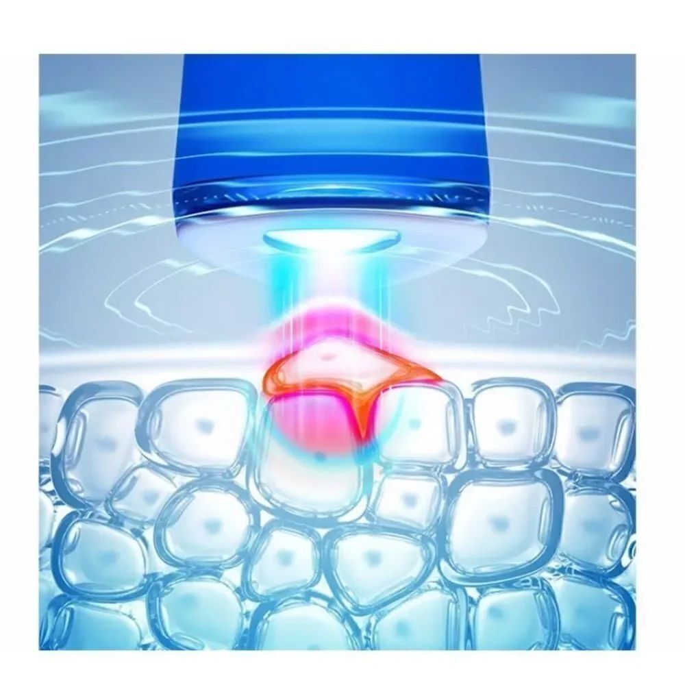 FOREO Blue Light Acne Treatment, Like New - Picture 2 of 4